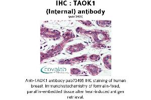Image no. 1 for anti-TAO Kinase 1 (TAOK1) (Internal Region) antibody (ABIN1739900) (TAO Kinase 1 (TAOK1) (Internal Region) Antikörper)