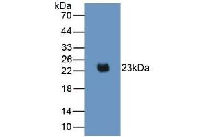 Detection of Recombinant IL2, Mouse using Monoclonal Antibody to Interleukin 2 (IL2) (IL-2 Antikörper  (AA 10-169))
