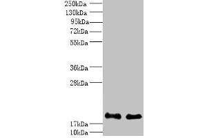 Western blot All lanes: PPP3R1 antibody at 1 μg/mL Lane 1: K562 whole cell lysate Lane 2: Hela whole cell lysate Secondary Goat polyclonal to rabbit IgG at 1/10000 dilution Predicted band size: 20 kDa Observed band size: 20 kDa (PPP3R1 Antikörper  (AA 11-170))