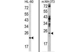 (LEFT) Western blot analysis of RAN Antibody (N-term) in HL-60 cell line lysates (35ug/lane). (RAN Antikörper  (N-Term))