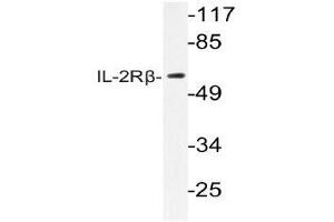 Western blot (WB) analysis of IL-2Rbeta antibody in extracts from RAW264. (IL2 Receptor beta Antikörper)