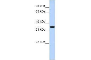 WB Suggested Anti-MARCH1 Antibody Titration:  0.