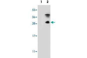 Western blot analysis of KLK7 (arrow) using KLK7 polyclonal antibody . (Kallikrein 7 Antikörper  (C-Term))