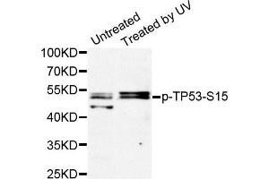 Western Blotting (WB) image for anti-Tumor Protein P53 (TP53) (pSer15) antibody (ABIN1870674) (p53 Antikörper  (pSer15))