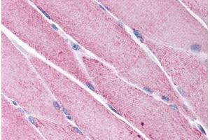 Human Skeletal Muscle (formalin-fixed, paraffin-embedded) stained with KCNG1 antibody ABIN214781 at 5 ug/ml followed by biotinylated goat anti-rabbit IgG secondary antibody ABIN481713, alkaline phosphatase-streptavidin and chromogen.