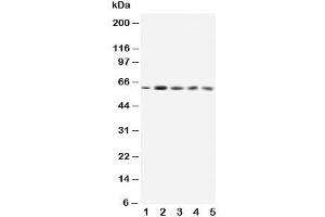 Western blot testing of GRB7 antibody and Lane 1:  rat testis;  2: SMMC-7721;  3: HeLa;  4: A549;  5: SW620;  Predicted size: 60KD;  Observed size: 60KD