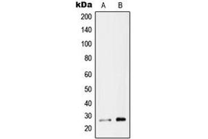 Western blot analysis of RAB26 expression in MCF7 (A), U87MG (B) whole cell lysates. (RAB26 Antikörper  (C-Term))