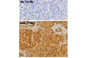 Immunohistochemistry (IHC) image for anti-STIP1 Homology and U-Box Containing Protein 1 (STUB1) antibody (ABIN6254206) (STUB1 Antikörper)
