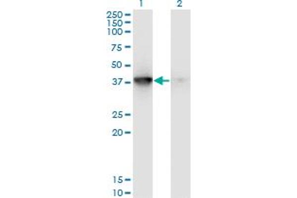 MAPKAP Kinase 3 Antikörper  (AA 272-382)