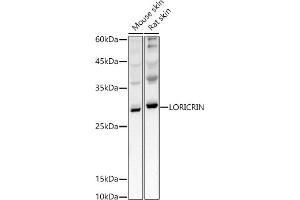 Western blot analysis of extracts of various cell lines, using LORICRIN antibody (ABIN7268295) at 1:1000 dilution. (LOR Antikörper)