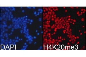 Immunofluorescence (IF) image for anti-Histone H4 (3meLys20) antibody (ABIN3016051)
