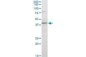 GNRHR2 monoclonal antibody (M01), clone 4A5.