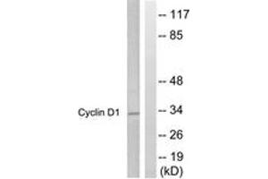 Western blot analysis of extracts from Jurkat cells, treated with EGF 200ng/ml 30', using Cyclin D1 (Ab-286) Antibody. (Cyclin D1 Antikörper  (AA 246-295))