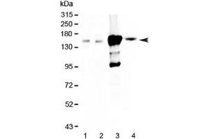 Western blot testing of 1) rat kidney, 2) mouse kidney, 3) human 293T and 4) human HK-2 lysate with Periaxin antibody at 0. (Periaxin Antikörper)