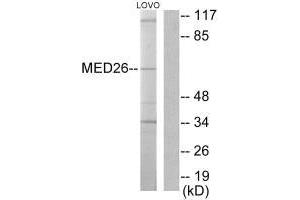 Western blot analysis of extracts from LOVO cells, using MED26 antibody. (MED26 Antikörper  (N-Term))