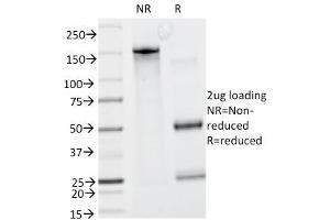SDS-PAGE Analysis Purified Caldesmon Mouse Monoclonal Antibody (CALD1/820). (Caldesmon Antikörper)