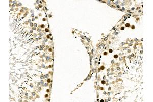 ABIN6257335 and ABIN6274168 at 1/100 staining Rat testis tissue by IHC-P.