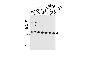 ICT1 Antibody (C-term) (ABIN1881444 and ABIN2843293) western blot analysis in Hela,Jurkat,,MDA-M,NCI-,K562,ZR-75-1 cell line lysates (35 μg/lane). (ICT1 Antikörper  (C-Term))