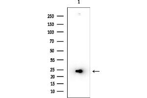 anti-Empty Spiracles Homeobox 1 (EMX1) (Internal Region) antibody