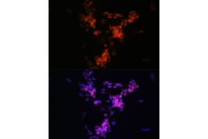 Immunofluorescence analysis of SH-SY5Y cells using CHAT Rabbit mAb (ABIN7266343) at dilution of 1:100 (40x lens). (Choline Acetyltransferase Antikörper)