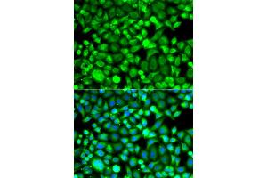 Immunofluorescence analysis of A549 cells using PSMB8 antibody. (PSMB8 Antikörper)