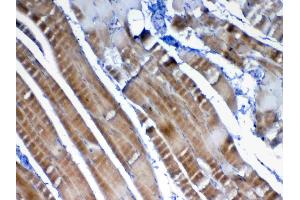 Immunohistochemistry (IHC) image for anti-Vascular Endothelial Growth Factor B (VEGFB) (AA 22-207) antibody (ABIN5692963)
