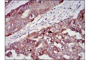 Immunohistochemistry (IHC) image for anti-Insulin-Like Growth Factor 2 (IGF2) (AA 25-180) antibody (ABIN1846026) (IGF2 Antikörper  (AA 25-180))