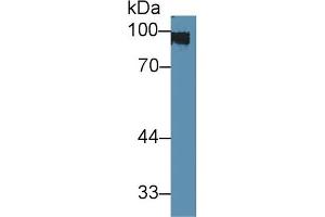 Detection of CK1 in Rat Skin lysate using Polyclonal Antibody to Cytokeratin 1 (CK1) (Cytokeratin 1 Antikörper  (AA 189-497))