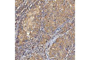 IHC analysis of TTLL2 using anti-TTLL2 antibody (ABIN7600850).