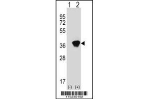 Western blot analysis of AKR1A1 using rabbit polyclonal AKR1A1 Antibody using 293 cell lysates (2 ug/lane) either nontransfected (Lane 1) or transiently transfected (Lane 2) with the AKR1A1 gene. (AKR1A1 Antikörper  (C-Term))