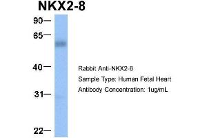 Host:  Rabbit  Target Name:  NKX2-8  Sample Type:  Human Fetal Heart  Antibody Dilution:  1. (NKX2-8 Antikörper  (C-Term))