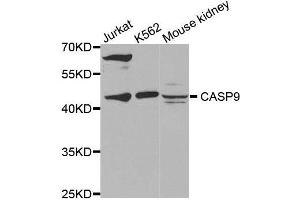 Western blot analysis of extracts of various cell lines, using CASP9 antibody. (Caspase 9 Antikörper)