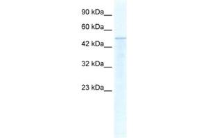 Western Blotting (WB) image for anti-Thyroid Hormone Receptor Interactor 10 (TRIP10) antibody (ABIN2460889) (TRIP10 Antikörper)