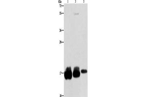 Western Blotting (WB) image for anti-Interferon-Induced Transmembrane Protein 3 (IFITM3) antibody (ABIN2422691) (IFITM3 Antikörper)