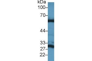 Western blot analysis of Mouse Liver lysate, using Mouse GLS2 Antibody (1 µg/ml) and HRP-conjugated Goat Anti-Rabbit antibody ( (GLS2 Antikörper  (AA 154-479))