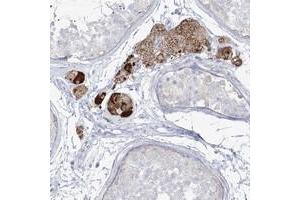 Immunohistochemical staining of human testis with ZNF843 polyclonal antibody  shows strong cytoplasmic positivity in Leydig cells.