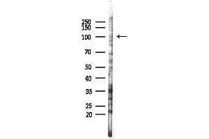 anti-ADAM Metallopeptidase Domain 22 (ADAM22) antibody