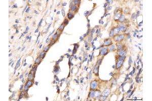 IHC analysis of PDE4DIP using anti-PDE4DIP antibody (ABIN7602691). (PDE4DIP Antikörper  (AA 96-1254))