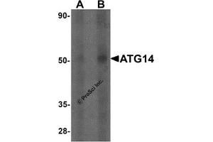 Western Blotting (WB) image for anti-ATG14 Autophagy Related 14 (ATG14) antibody (ABIN1077377) (ATG14 Antikörper)