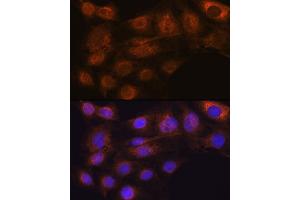 Immunofluorescence analysis of C6 cells using  Rabbit mAb (ABIN7265485) at dilution of 1:100 (40x lens). (ARF6 Antikörper)