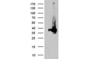 Western Blotting (WB) image for anti-Low Density Lipoprotein Receptor Adaptor Protein 1 (LDLRAP1) antibody (ABIN1496691)