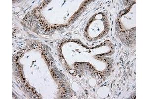 Immunohistochemical staining of paraffin-embedded Kidney tissue using anti-RC203219 mouse monoclonal antibody.
