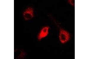 Immunofluorescent analysis of IDE staining in A549 cells. (IDE Antikörper)