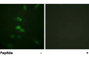 Immunofluorescence analysis of HeLa cells, using CDC25B polyclonal antibody . (CDC25B Antikörper)