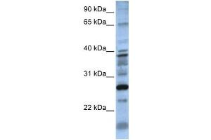 Western Blotting (WB) image for anti-Dolichyl Pyrophosphate Phosphatase 1 (DOLPP1) antibody (ABIN2459296) (DOLPP1 Antikörper)