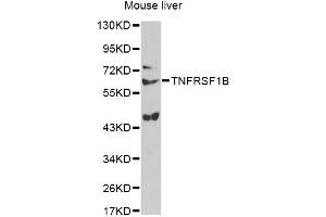 Western blot analysis of extracts of mouse liver, using TNFRSF1B antibody (ABIN6291033) at 1:1000 dilution. (TNFRSF1B Antikörper)