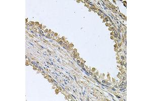 Immunohistochemistry of paraffin-embedded human prostate using MEMO1 antibody (ABIN5995855) at dilution of 1/100 (40x lens). (MEMO1 Antikörper)