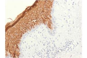 Formalin-fixed, paraffin-embedded human skin stained with Cytokeratin 10 Rabbit Recombinant Monoclonal Antibody (KRT10/1948R). (Rekombinanter Keratin 10 Antikörper)