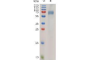SDS-PAGE (SDS) image for Leukocyte Immunoglobulin-Like Receptor, Subfamily B (With TM and ITIM Domains), Member 2 (LILRB2) (AA 22-461) protein (His tag) (ABIN7490895)