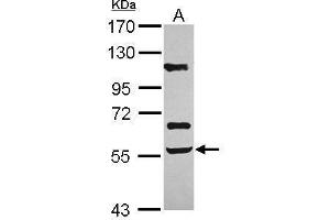 WB Image Sample (30 ug of whole cell lysate) A: U87-MG 7. (ACVR2B Antikörper  (Center))